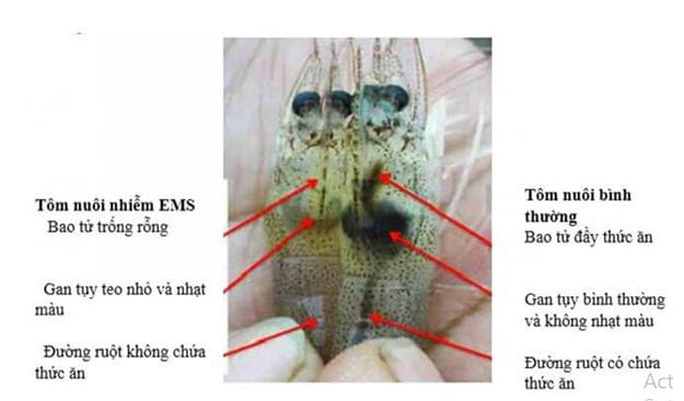 OTC – QUA - Giải pháp đặc trị gan tụy, nhiễm khuẩn, phân trắng - Ảnh 3